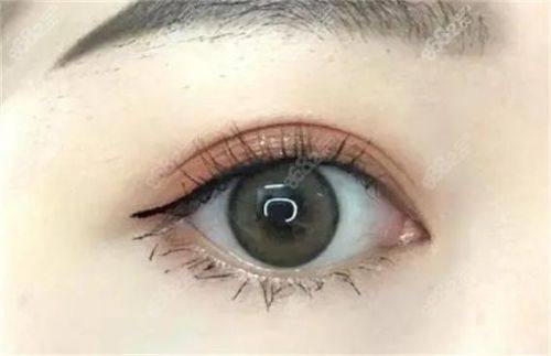 济宁医莱美玖愿整形医院口碑评价：