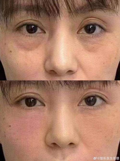 成都美钰蓉美整形医院擅长项目: