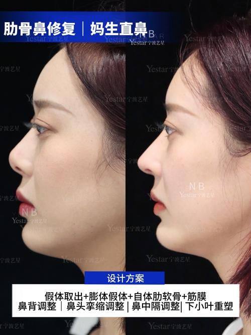 大连曹建平医学美容门诊医生名单及擅长领域：