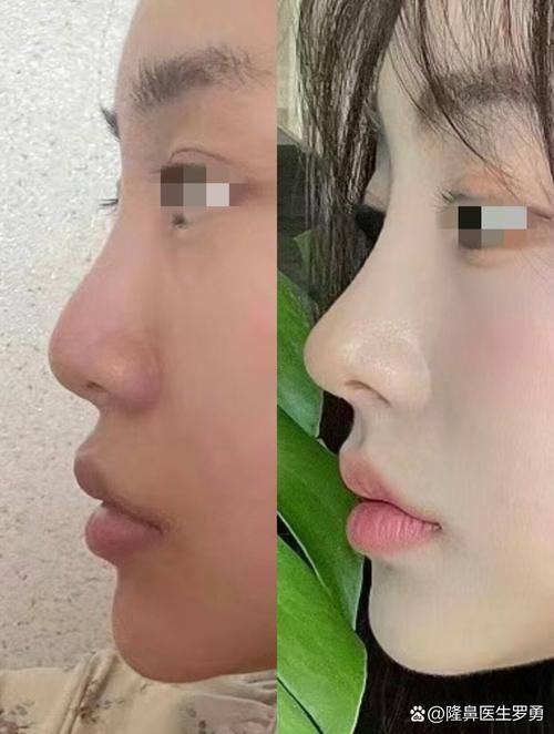 合肥立新整形医院擅长项目：