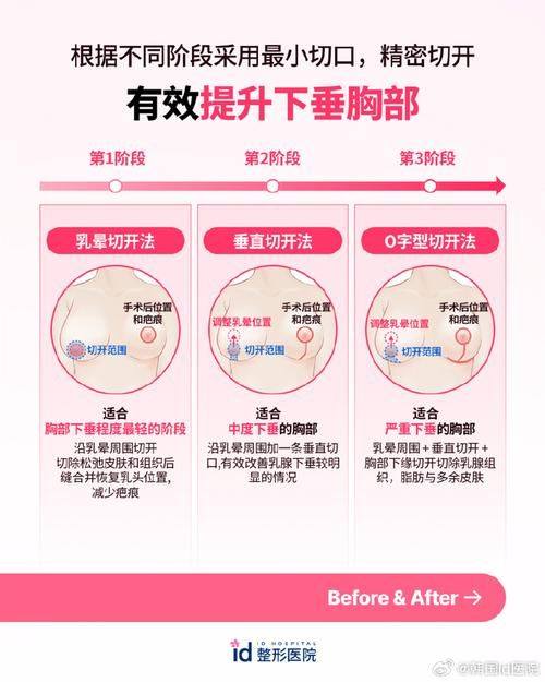 张金明医生技术优势