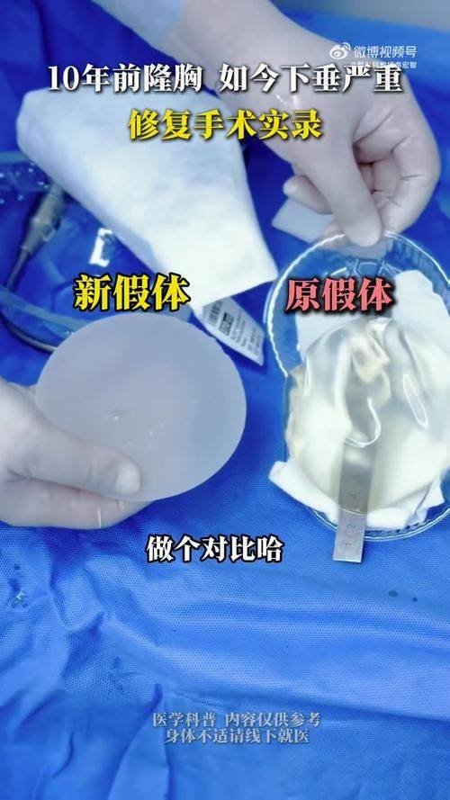 徐国建医生技术优势