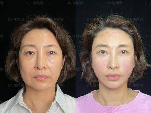 长沙市温宏医疗美容诊所怎么样？