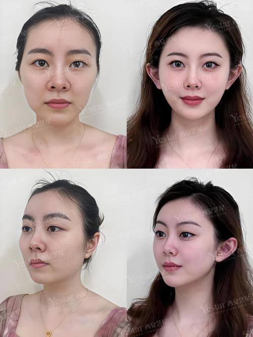 白玲医生口碑评价