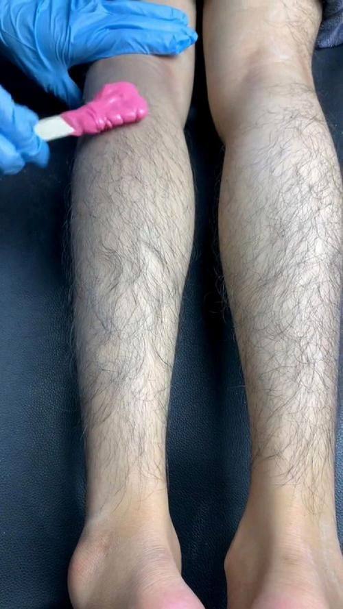 刘广元医生怎么预约？