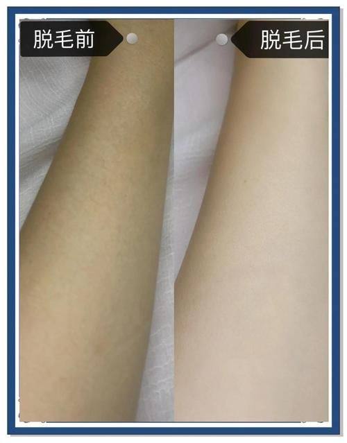 杭州微津美医疗美容诊所价格表：