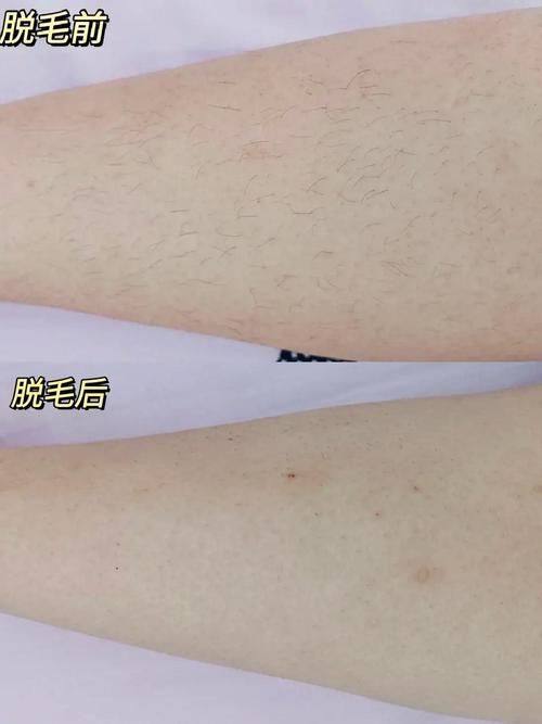 刘广元医生口碑评价：