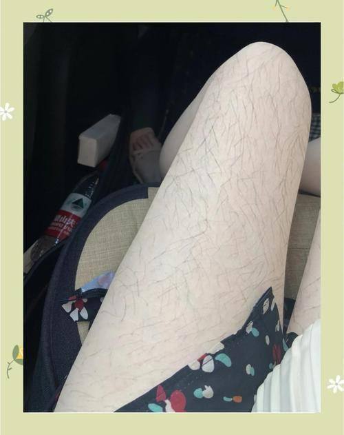 何诗雨医生口碑评价