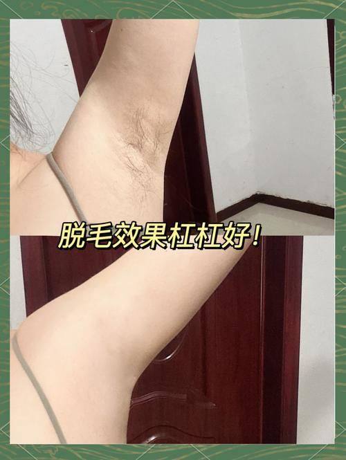 长沙芙蓉区鹏爱医疗美容中 心预约挂号方式