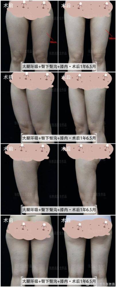 北京济华医院博通美容整形医生名单及擅长领域