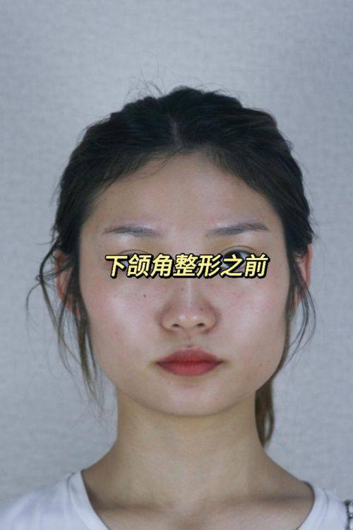 李廷友医生口碑评价