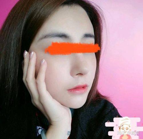 威海佳医整形预约挂号方式