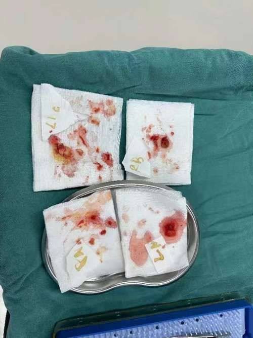 黄伦武医生技术优势