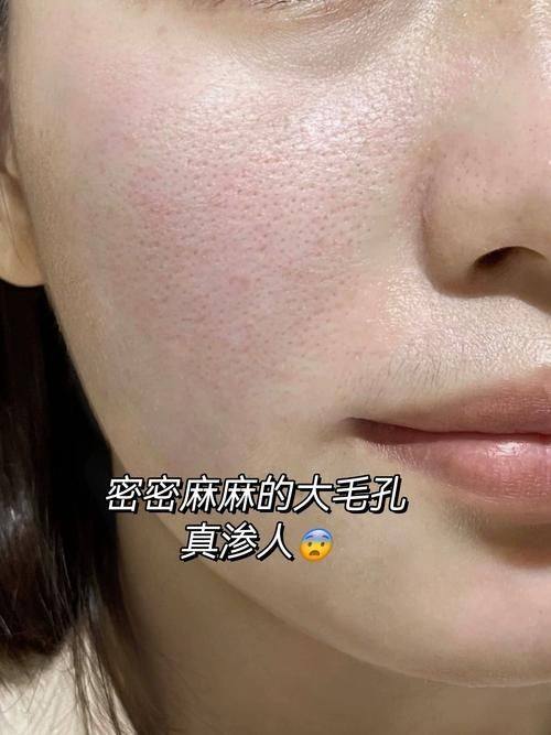 刘娟娟医生怎么预约