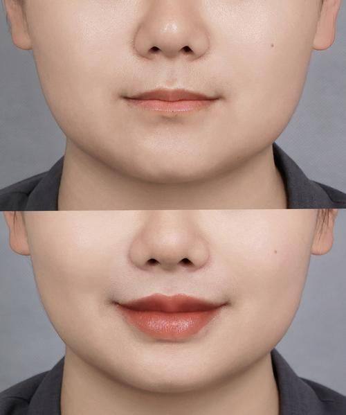 钟夏医生怎么预约