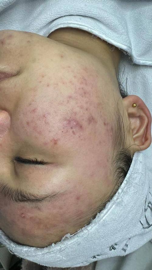 天津奥霏医疗美容诊所擅长项目：