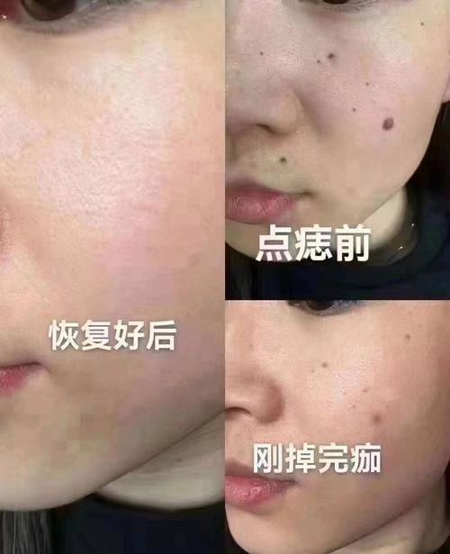 陈秋怡医生怎么预约？