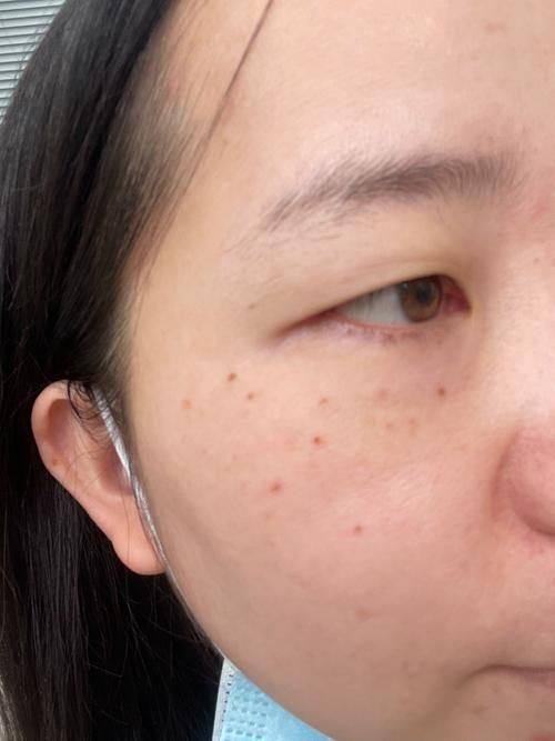 李若华医生怎么预约？