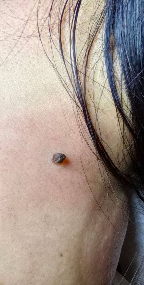 谭娜娜医生怎么预约