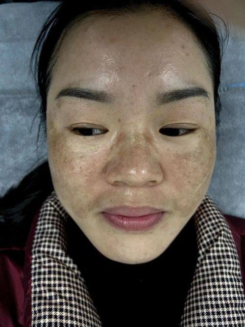 刘俊伟医生怎么预约