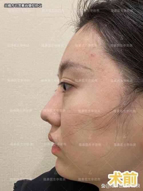 潘竹林医生怎么预约