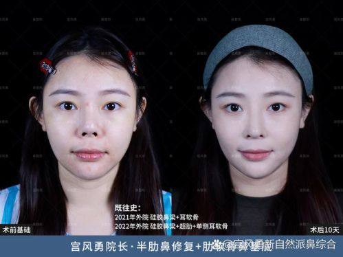 罗远亮医生技术优势