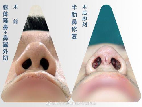 杨艳清医生怎么预约?