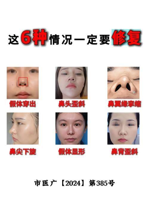 杨艳清医生擅长领域: