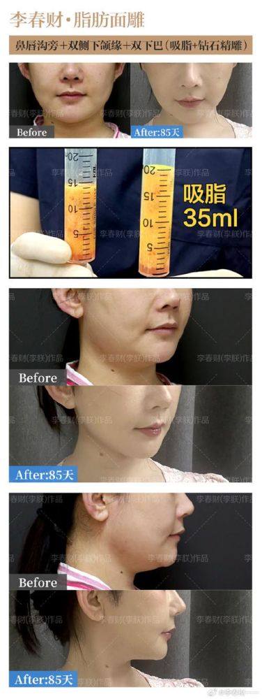 杭州微津美医疗美容诊所口碑评价：