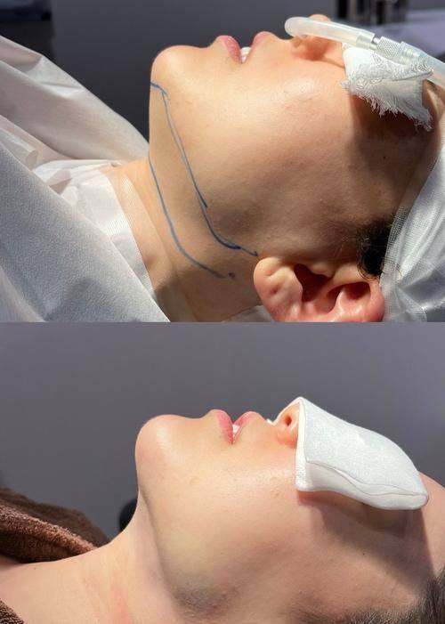 成都武侯檬悦医疗美容诊所怎么样