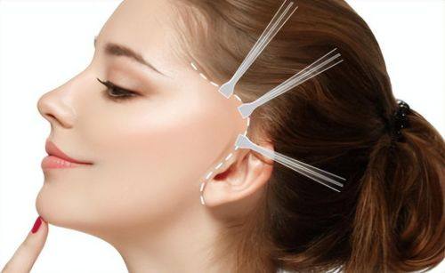 刘广元医生技术优势：