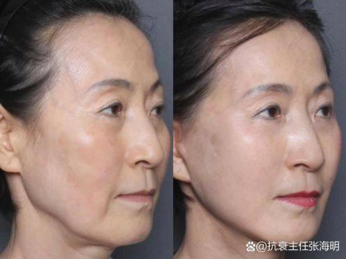 李宗磊医生技术优势