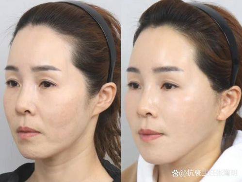 合肥立新整形医院医生名单及擅长领域：