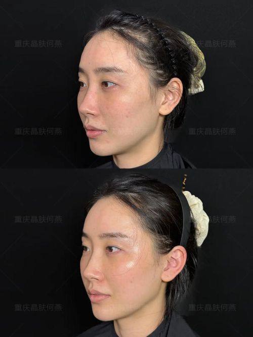 何诗雨医生技术优势