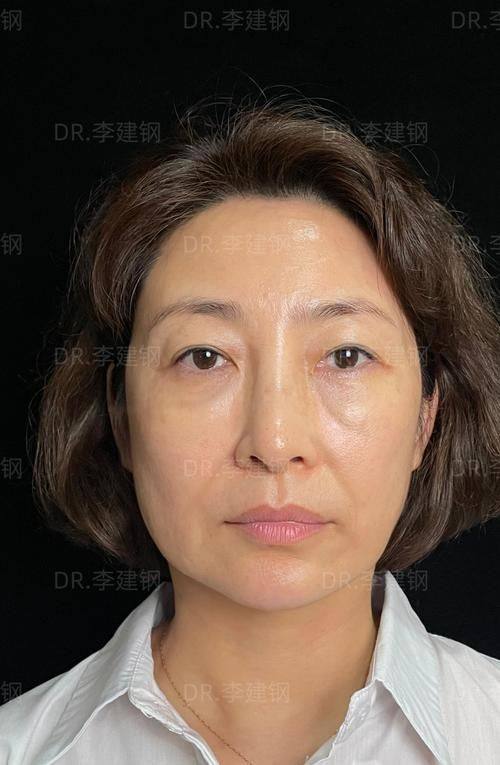 徐国建医生怎么预约