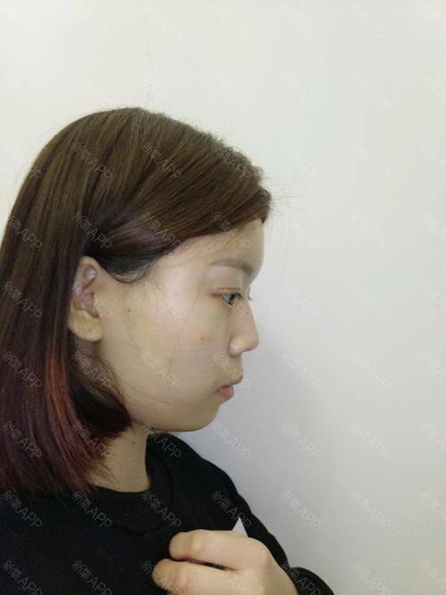 滁州东方伊尔美整形医院预约挂号方式