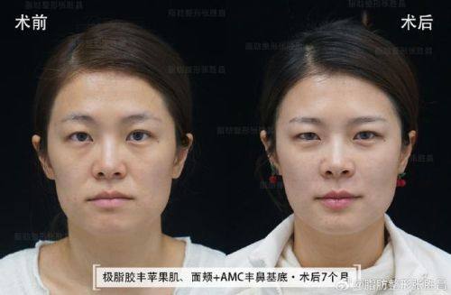 滁州东方伊尔美整形医院地址电话及营业时间