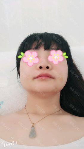 滁州东方伊尔美整形医院口碑评价