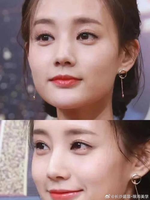 李宗磊医生口碑评价