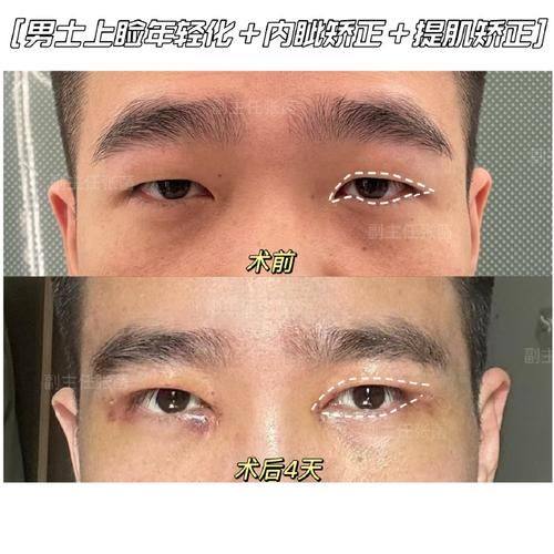 徐家明医生擅长领域