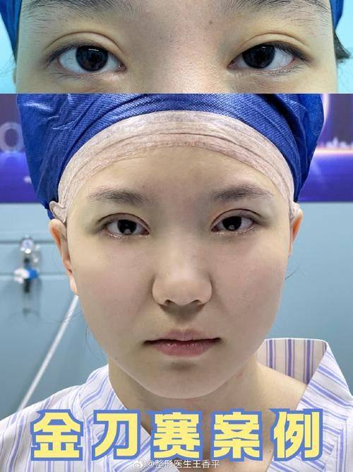 北京济华医院博通美容整形价格表