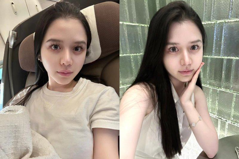 切眉的疤痕能去除吗?理性看待修复成效