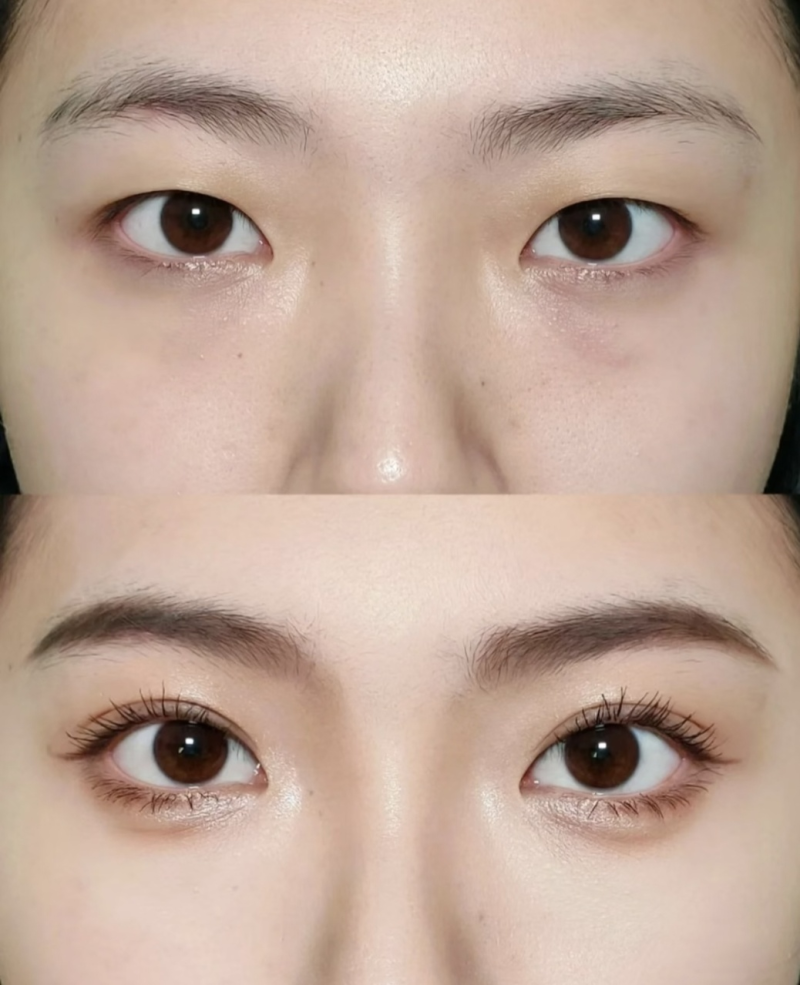 合肥立新整形医院口碑评价：