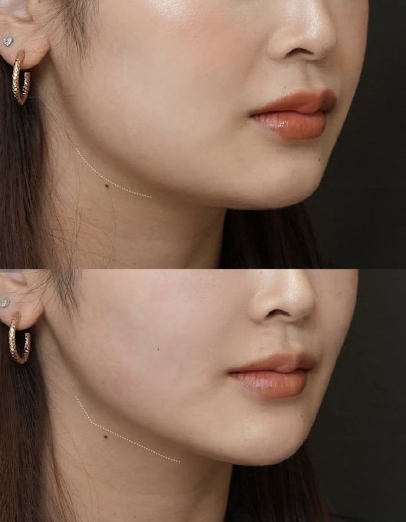 李廷友医生怎么预约