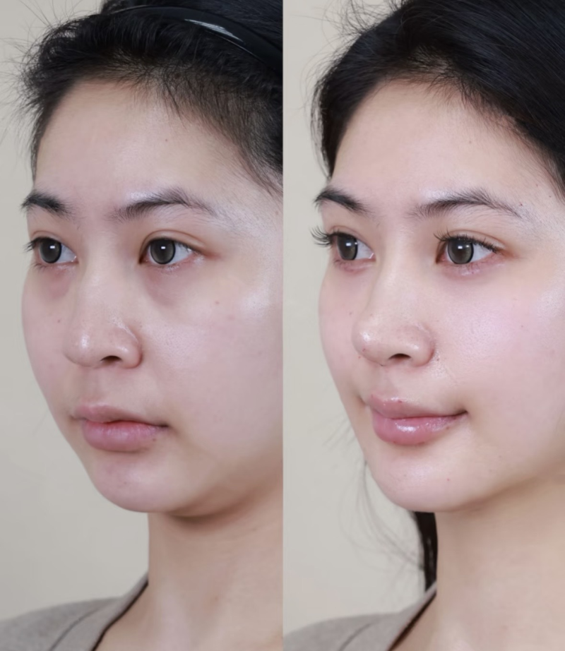 万鹏医生擅长领域