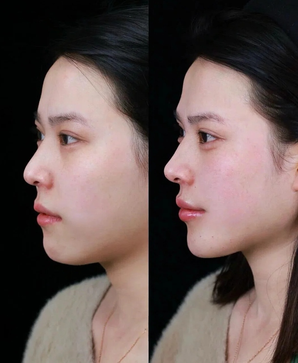 五、激素、肤色与年龄：影响发病的关键个体因素