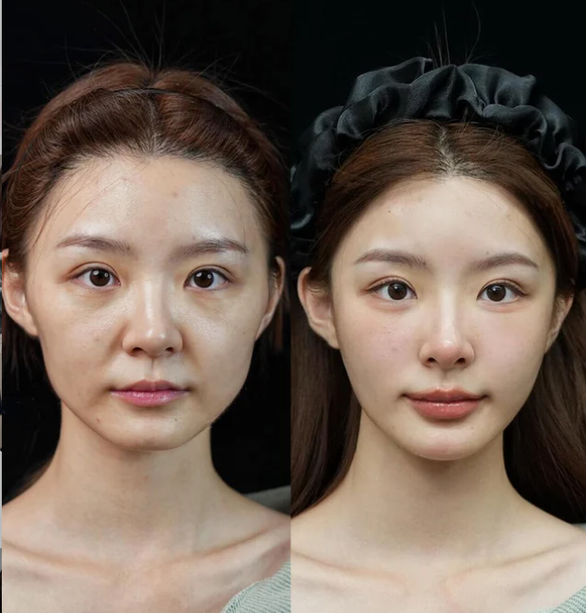 六、皮肤张力与部位：不可忽视的环境诱因