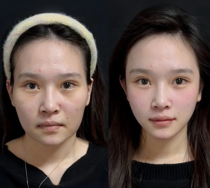 三、伤口愈合异常：隐形的增生推手