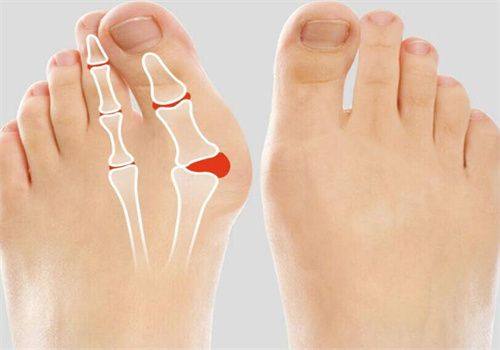 三、药物干预:针对性改善疤痕增生、色素沉着等问题