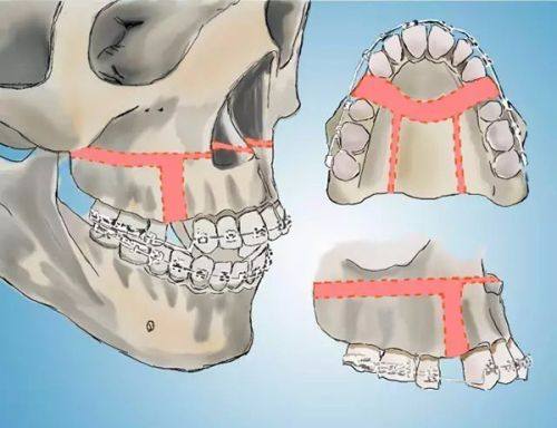 何毅明医生擅长领域：
